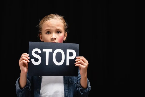 Barn Med Blåmärken Kinden Håller Kort Med Stopp Bokstäver Isolerad — Stockfoto