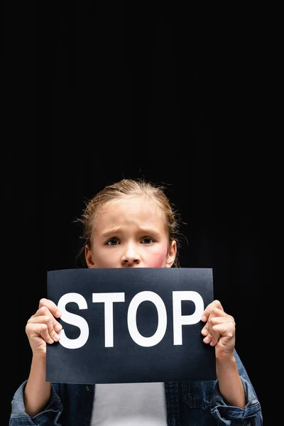 Φοβισμένο Παιδί Αιμάτωμα Στο Μάγουλο Κρατώντας Κάρτα Stop Lettering Απομονώνονται — Φωτογραφία Αρχείου