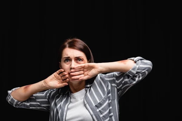 Mujer Asustada Con Moretones Mirando Cámara Aislada Negro — Foto de Stock