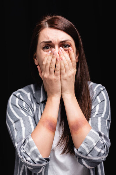 Depressed woman with bruises on hands covering mouth isolated on black 