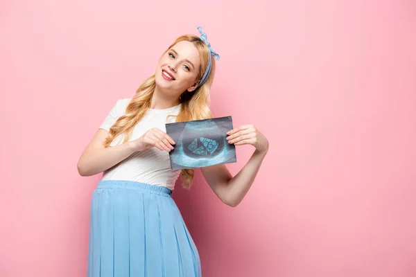 Glad Blond Ung Gravid Kvinna Med Ultraljud Scan Med Pizza — Stockfoto