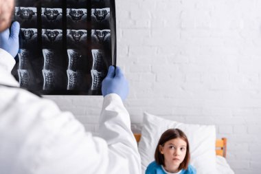 X-ray 'in seçici odak noktası, hastanedeki yatağında oturan doktorun ellerinde.