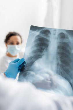 radiologist in latex glove holding lungs x-ray near african american woman in medical mask on blurred background clipart
