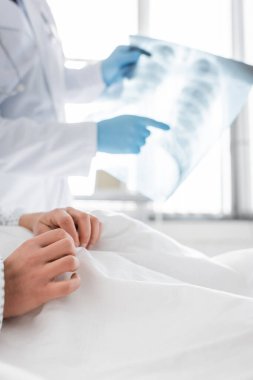cropped view of radiologist in latex gloves pointing at lungs x-ray near patient in hospital, blurred background clipart