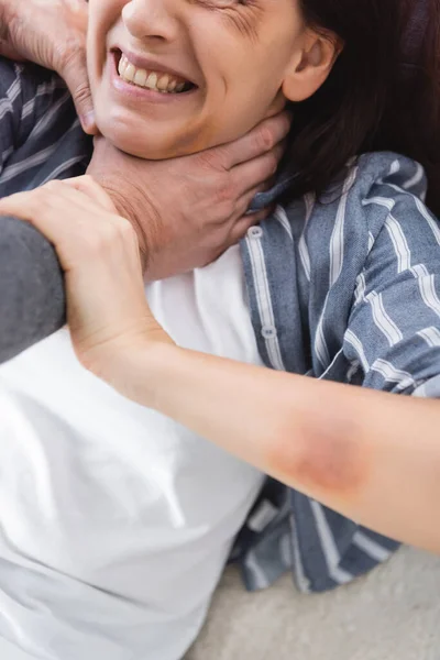 Cropped view of abusive husband choking wife with bruises — Stock Photo