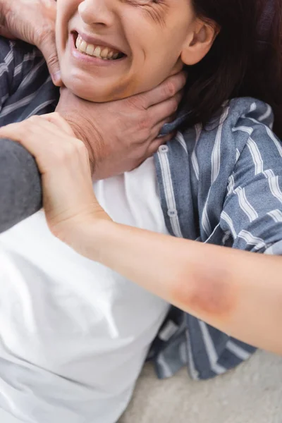 Vue recadrée de mari violent étouffant femme avec des ecchymoses — Photo de stock