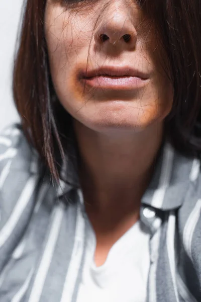 Abgeschnittener Blick auf blaue Flecken im Gesicht von Opfern häuslicher Gewalt — Stockfoto