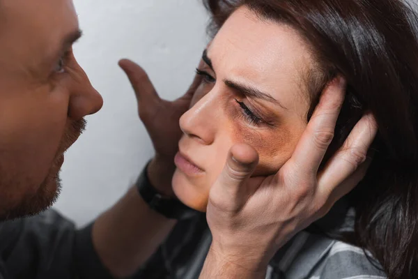 Homem agressivo tocando rosto de esposa com hematomas — Fotografia de Stock