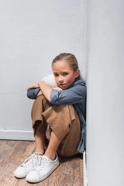 Verängstigtes Kind mit blauen Flecken im Gesicht umarmt Stofftier auf dem Boden — Stockfoto