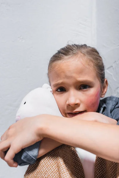 Frightened victim of domestic violence with bruise on cheek hugging soft toy — Stock Photo