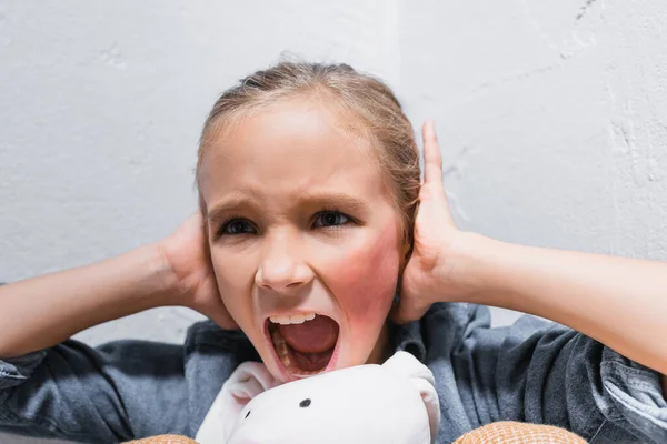 Chica gritando con moretones en la cara cubriendo las orejas con las manos cerca de juguete suave - foto de stock