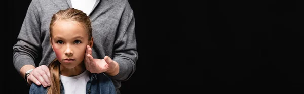 Abuser touching cheek of daughter with bruise isolated on black, banner — Stock Photo