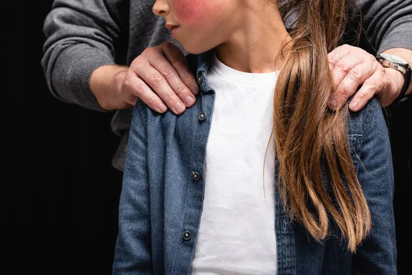 Cropped view of father embracing daughter with bruise isolated on black — Stock Photo