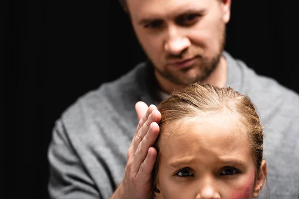 Pai abusivo no fundo borrado que toca a cabeça da filha com hematoma na bochecha isolada no preto — Fotografia de Stock