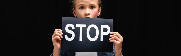 Victim of domestic violence with bruise on cheek holding card with stop lettering isolated on black, banner — Stock Photo