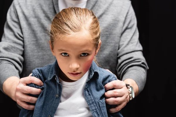 Bambino con ematoma sul viso guardando la fotocamera vicino padre abusivo su sfondo sfocato isolato su nero — Foto stock