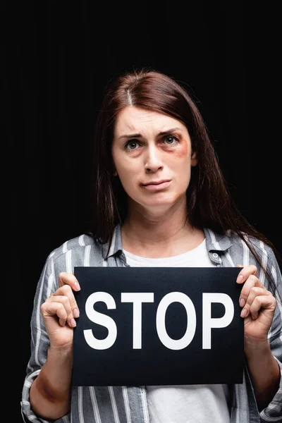 Mujer deprimida con moretones en la mano y la cara que sostiene la tarjeta con letras de stop aisladas en negro - foto de stock