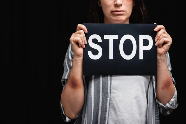 Cropped view of woman with bruises on hands holding card with stop lettering isolated on black — Stock Photo