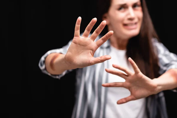 Mujer con moretones en las manos que no muestran ningún gesto sobre fondo borroso aislado en negro — Stock Photo