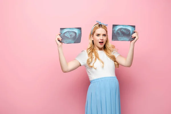 Schockierte blonde junge schwangere Frau mit Ultraschalluntersuchung mit Pizza und Fisch auf rosa Hintergrund — Stockfoto