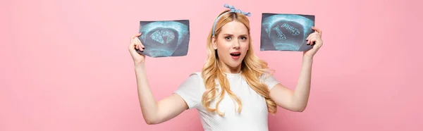 Shocked blonde young pregnant woman with ultrasound scan with pizza and fish on pink background, banner — Stock Photo