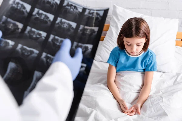 Arzt zeigt auf Röntgenbild nahe aufgebrachtem Mädchen, das im Krankenhaus auf Bett sitzt — Stockfoto
