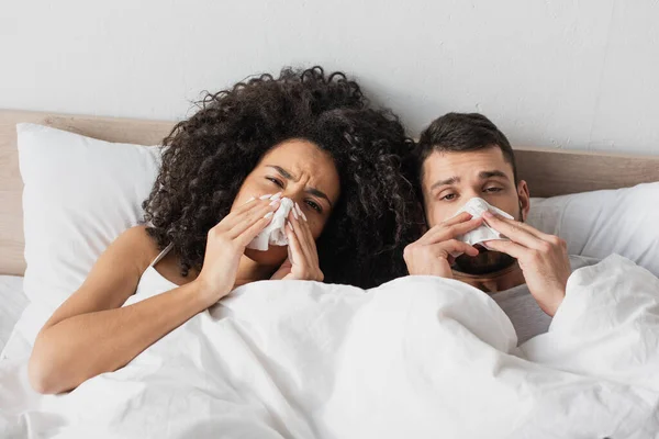 Sick interracial couple holding napkins and sneezing while looking at camera — Stock Photo