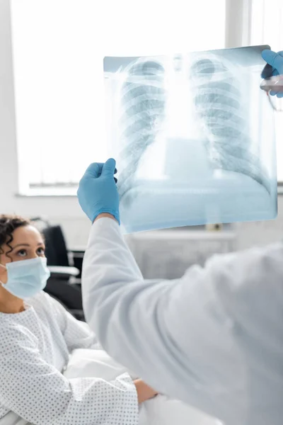Poumons radiographie dans les mains du médecin en gants de latex près de femme afro-américaine en masque médical sur fond flou — Photo de stock