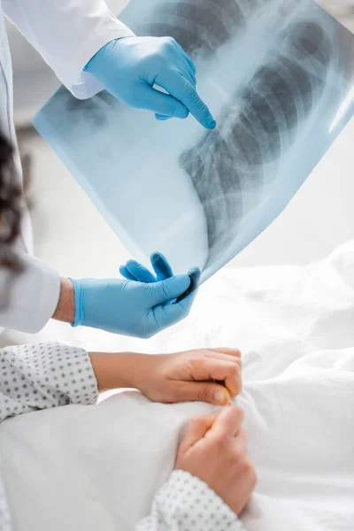 Vista parcial del radiólogo en guantes de látex apuntando a la radiografía de los pulmones cerca del paciente en primer plano borroso - foto de stock