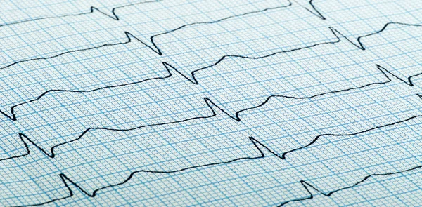 Cardiograma do batimento cardíaco — Fotografia de Stock