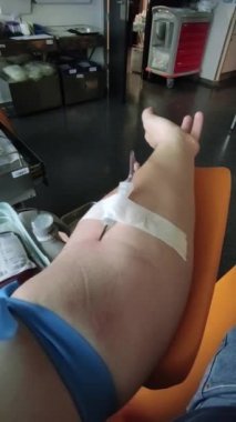 Kana bulanmış bir kol. Fedakâr kan bağışı. Bir hastanenin POV 'u..
