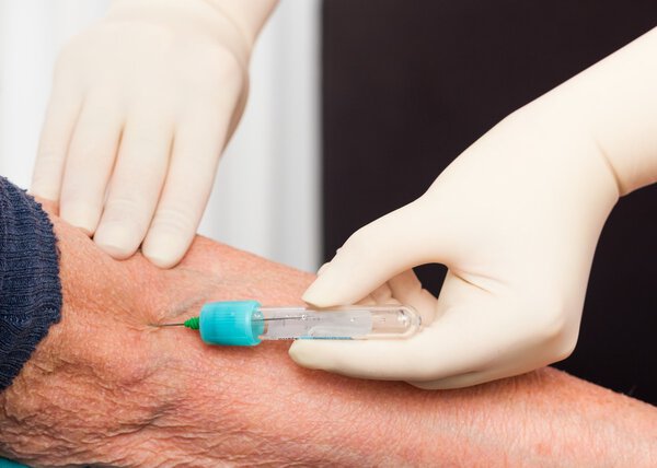 Blood Tests for Elderly