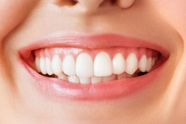 Dentes saudáveis perfeitos sorriso de uma jovem mulher. Clareamento dos dentes. Cuidados dentários, conceito de estomatologia. — Fotografia de Stock