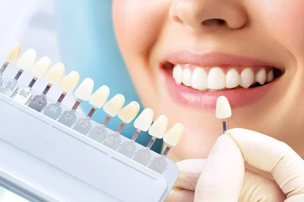 Una giovane donna sorridente. Denti cosmetici sbiancamento in una clinica dentale. selezione del tono del dente dell'impianto — Foto Stock