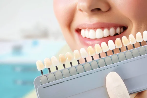 Una joven sonriente. Blanqueamiento dental cosmetológico en una clínica dental. selección del tono del diente del implante — Foto de Stock