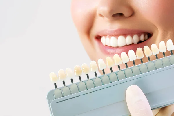 Una joven sonriente. Blanqueamiento dental cosmetológico en una clínica dental. selección del tono del diente del implante — Foto de Stock