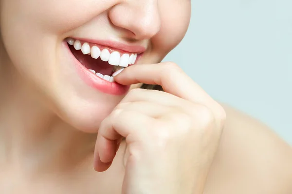 Hermosa sonrisa femenina después del procedimiento de blanqueamiento de dientes. Cuidado dental. Concepto odontológico — Foto de Stock