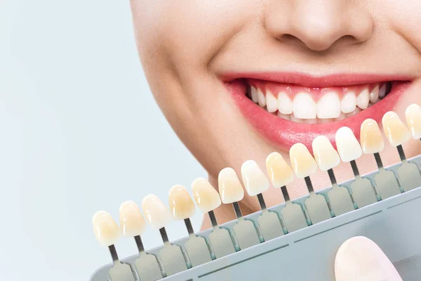 Smiling young woman. Cosmetological teeth whitening in a dental clinic. selection of the tone of the implant tooth — Stock Photo, Image