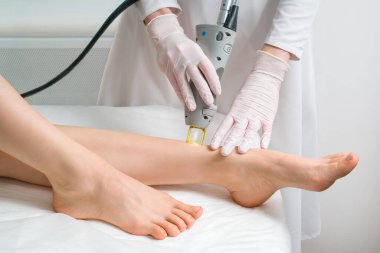 Kozmetik kliniğinde bir kadının vücudundaki kılların alınması prosedürü. Lazer tüy dökücü..