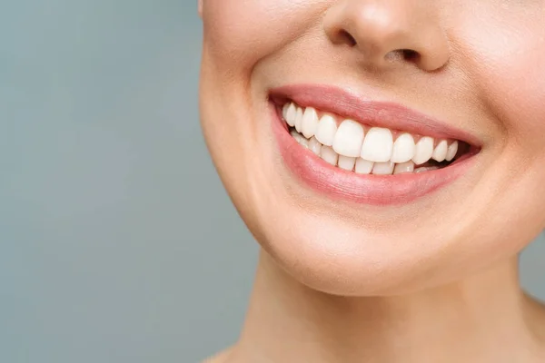 Sonrisa de dientes sanos perfectos de una mujer joven. Blanqueamiento dental. Cuidado dental, concepto de estomatología. — Foto de Stock