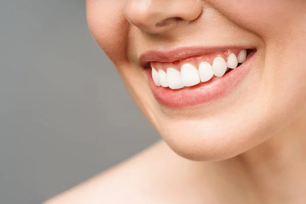 젊은 여자의 완벽 한 건강 한 치아 미소. 치아를 하얗게 만드는 일. 치과 환자에요. 이미 지는 구강 치 의학, 기형학을 상징한다 — 스톡 사진