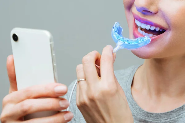 Uma jovem está envolvida em clareamento dos dentes em casa. Complexo para clareamento dos dentes com lâmpada UV — Fotografia de Stock