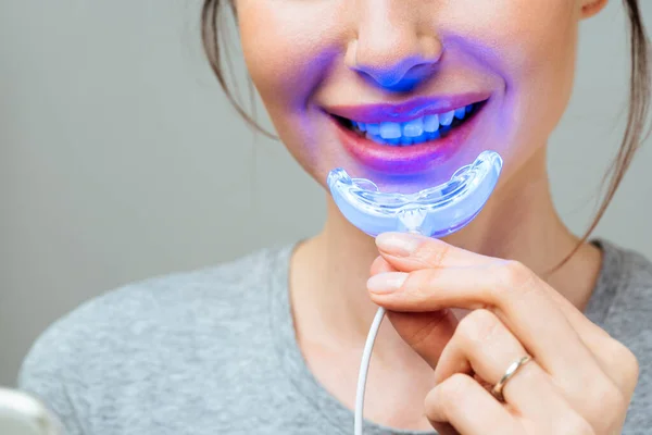 Mladá žena se zabývá bělením zubů. Komplex pro bělení zubů s UV lampou — Stock fotografie