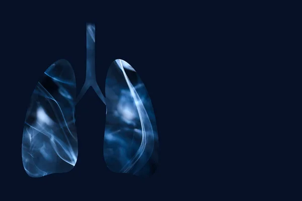 Tüdő Tele Füsttel Vízszintes Kép Sötétkék Háttérrel Másoló Térrel Dohányzás — Stock Fotó