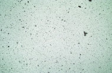 Bulanık lekelerin çeşitli şekilleri ve boyutları bir sürü kopya alanı olan ilginç bir arkaplan ya da doku oluşturur. Bu yeşil renk Aziz Patrick Günü ya da bahar teması için iyi olabilir..