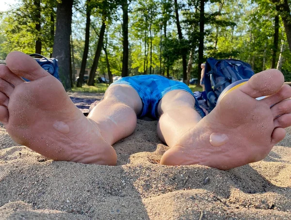 Ampollas pies desnudos después de jugar voleibol de playa en la arena caliente. El hombre con quemaduras o callos en las plantas está descansando en un parque. Estilo de vida. — Foto de Stock