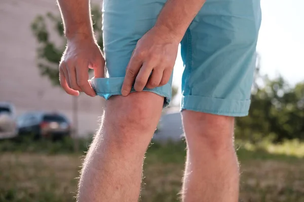 Homem endireita a lapela de shorts, ao ar livre, em um dia ensolarado, contra um fundo turvo. Close-up. — Fotografia de Stock