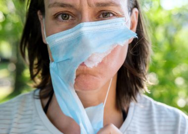 Yırtık bir maske takmış mutsuz, yorgun bir kadının portresi. Virüsü yenme ve salgını sona erdirme kavramı. 