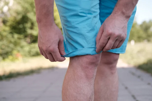 Mann richtet das Revers seiner Shorts, während er auf dem Bürgersteig steht, draußen, an einem sommerlichen, sonnigen Tag. Nahaufnahme. — Stockfoto