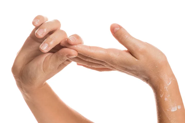 Female hands and moisturizing cream — Stock Photo, Image